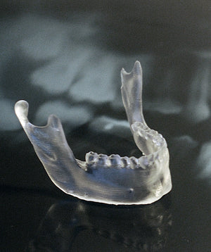 PRODUCTION - CBCT Conversion plus 3D Printed High Quality Clear Model