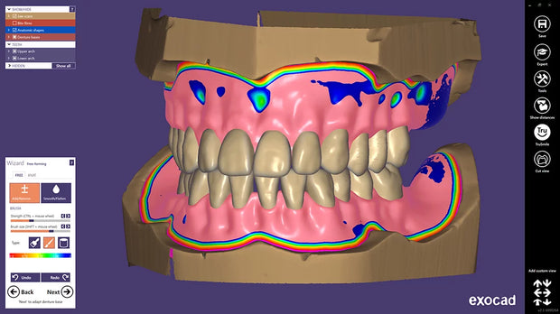 Full Denture Design - Single Arch (Any number of teeth)